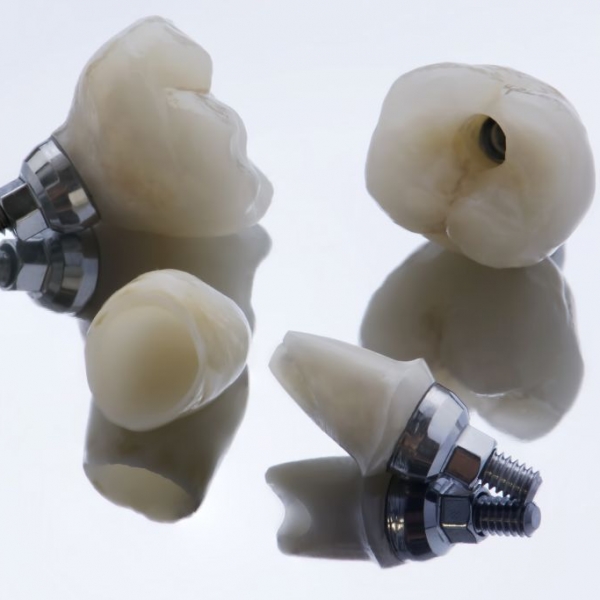 Trauma ant implantų protezuotiems dantims: kokie galimi sprendimo būdai? 